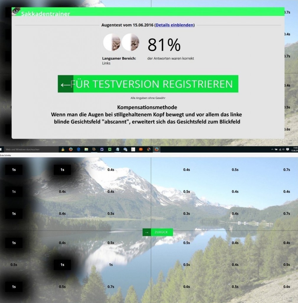 Eigene Gesichtsfeldmessung dynamisch