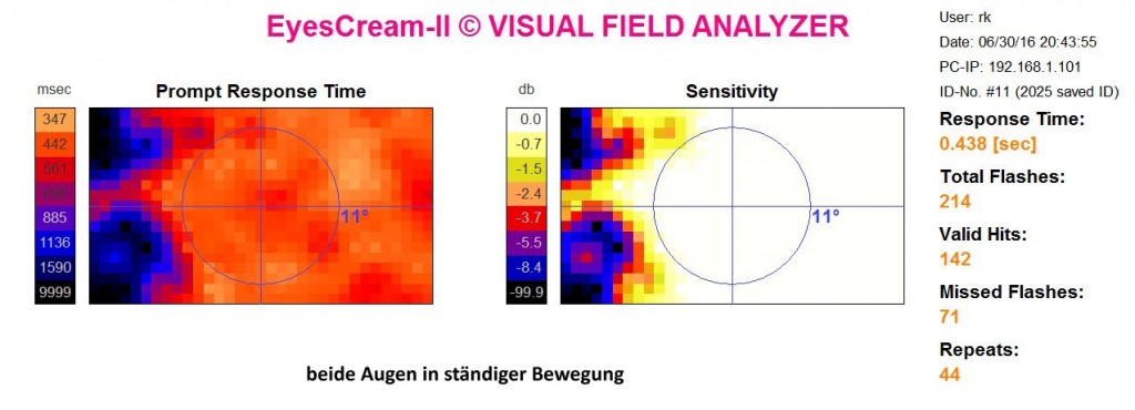 Eigene Gesichtsfeldmessung dynamisch 2